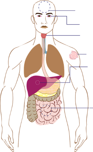 8체질 자가진단 테스트 나의 체질 알아보는 방법 
