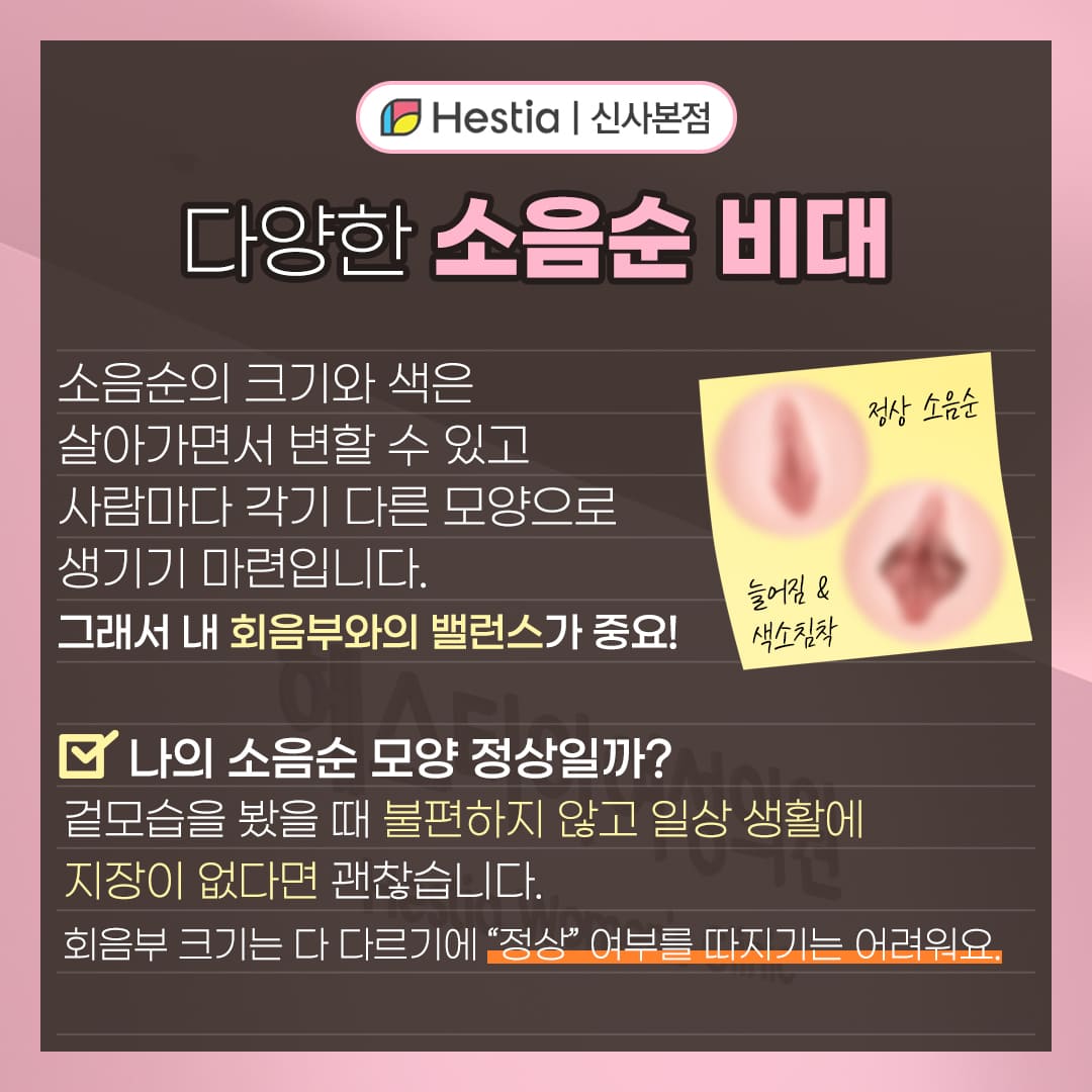다양한 소음순 비대