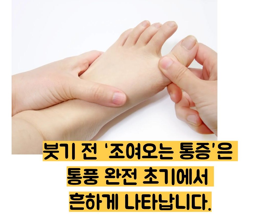 발가락 통풍완전초기증상