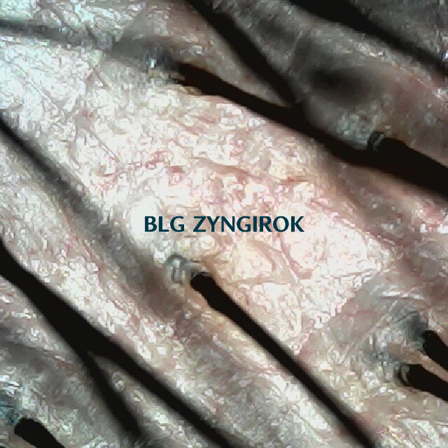 탈모 극복 프로젝트 - 뒷머리 두피모습이다.