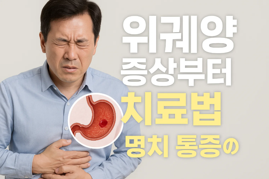 위궤양 증상부터 치료법 (+명치 통증의 진실)