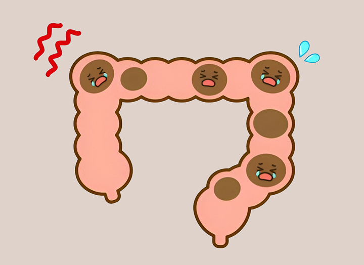 소화-기능-개선과-변비-예방