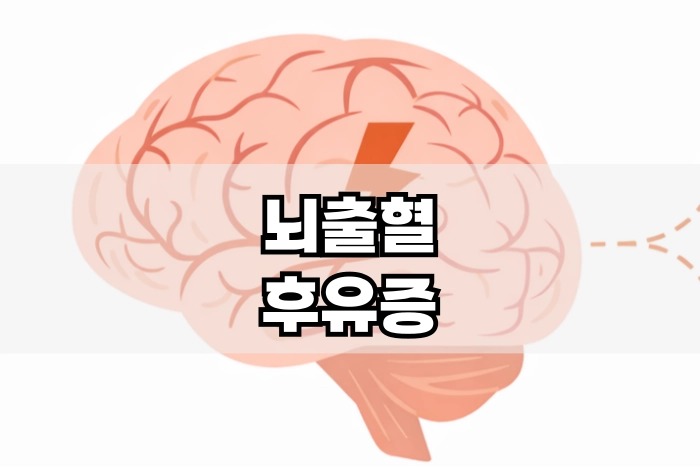 뇌출혈 후유증