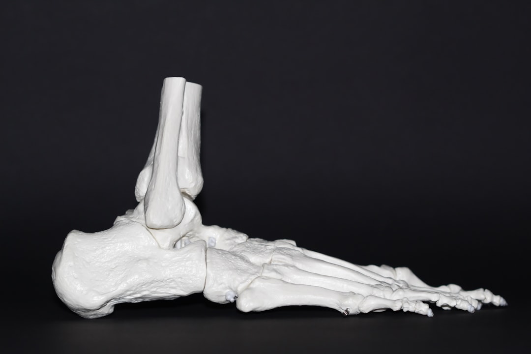 Foot pain