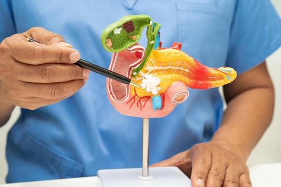 담낭염(Gallbladder Inflammation): 원인, 증상, 치료 및 예방
