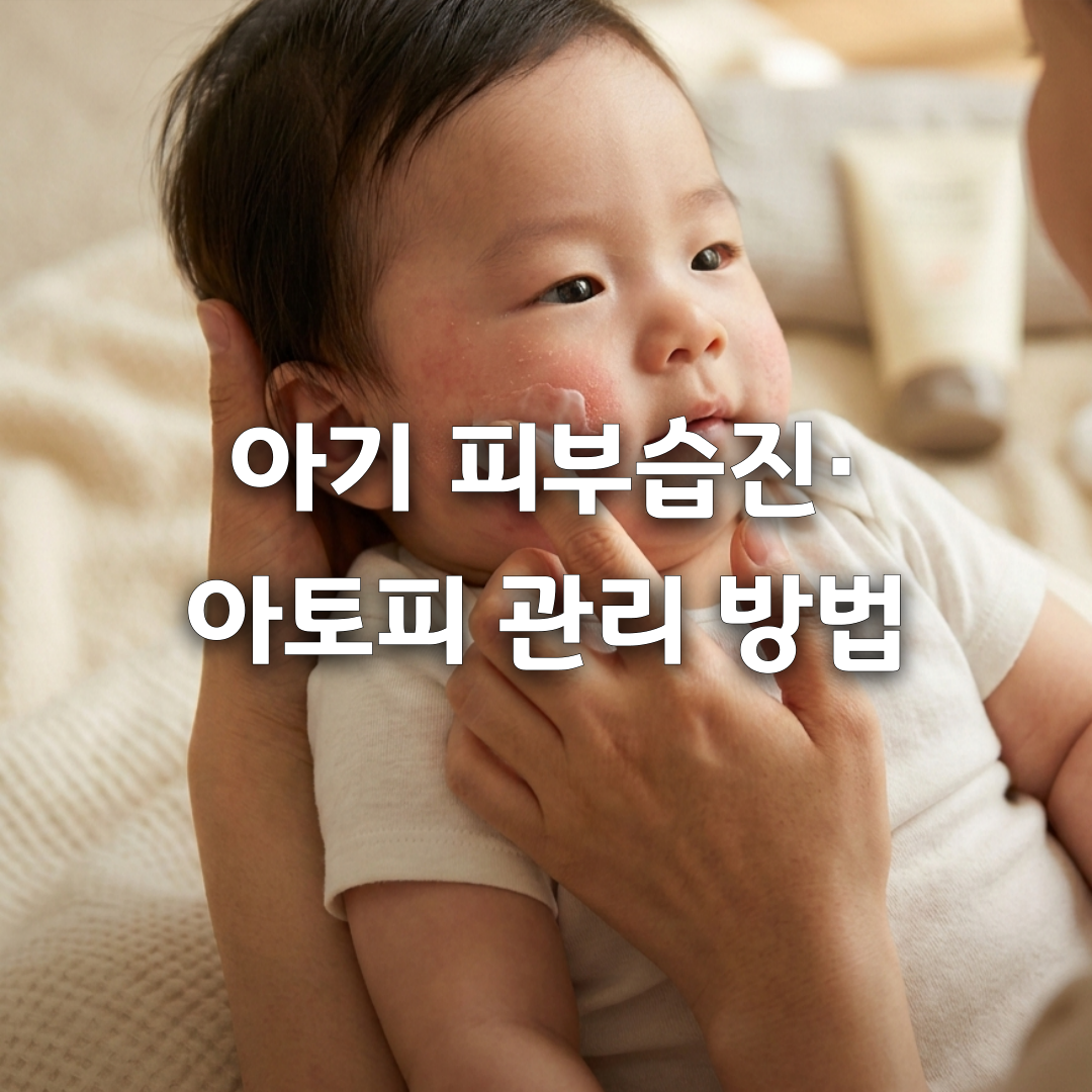 아기 피부 습진&middot;아토피, 집에서 관리하는 방법 총정리 ✔