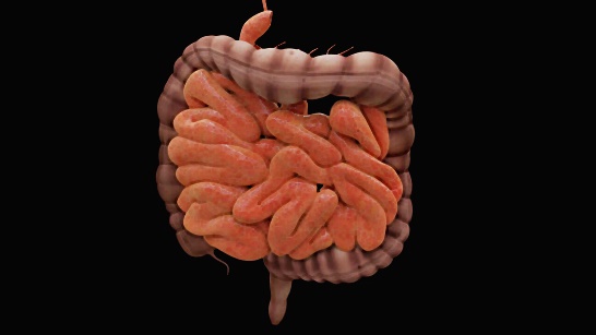 대장암초기증상-이미지