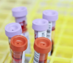 폐경기 전조증상 대처법