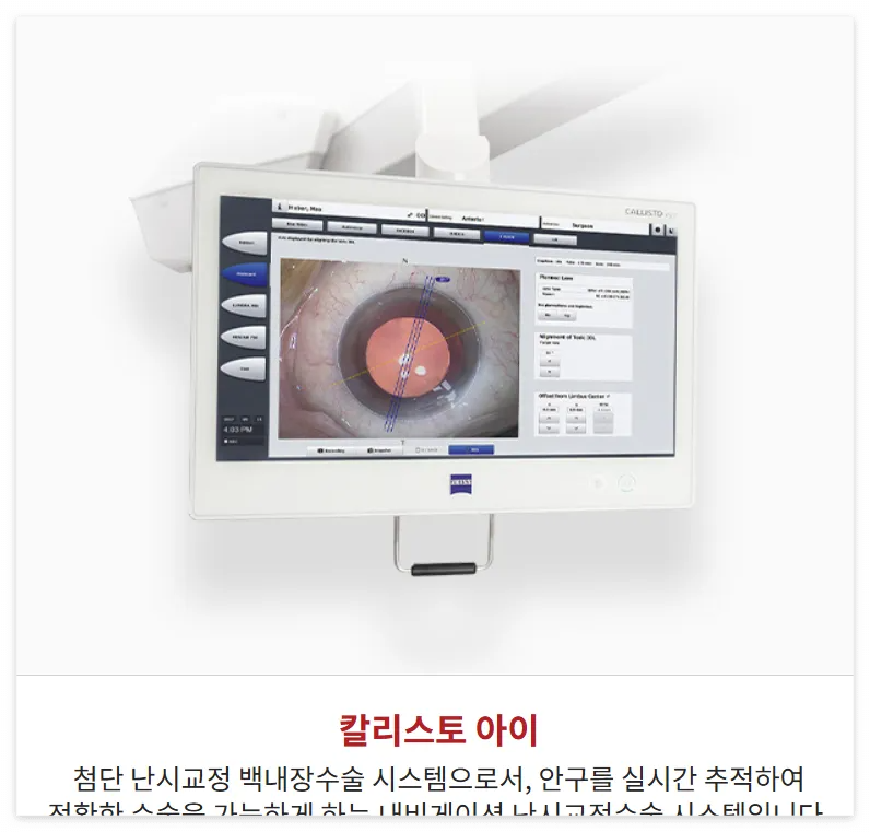 안산-백내장-에스안과-온라인-상담-바로가기