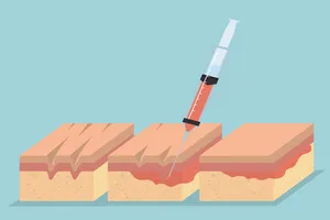 보톡스-가격