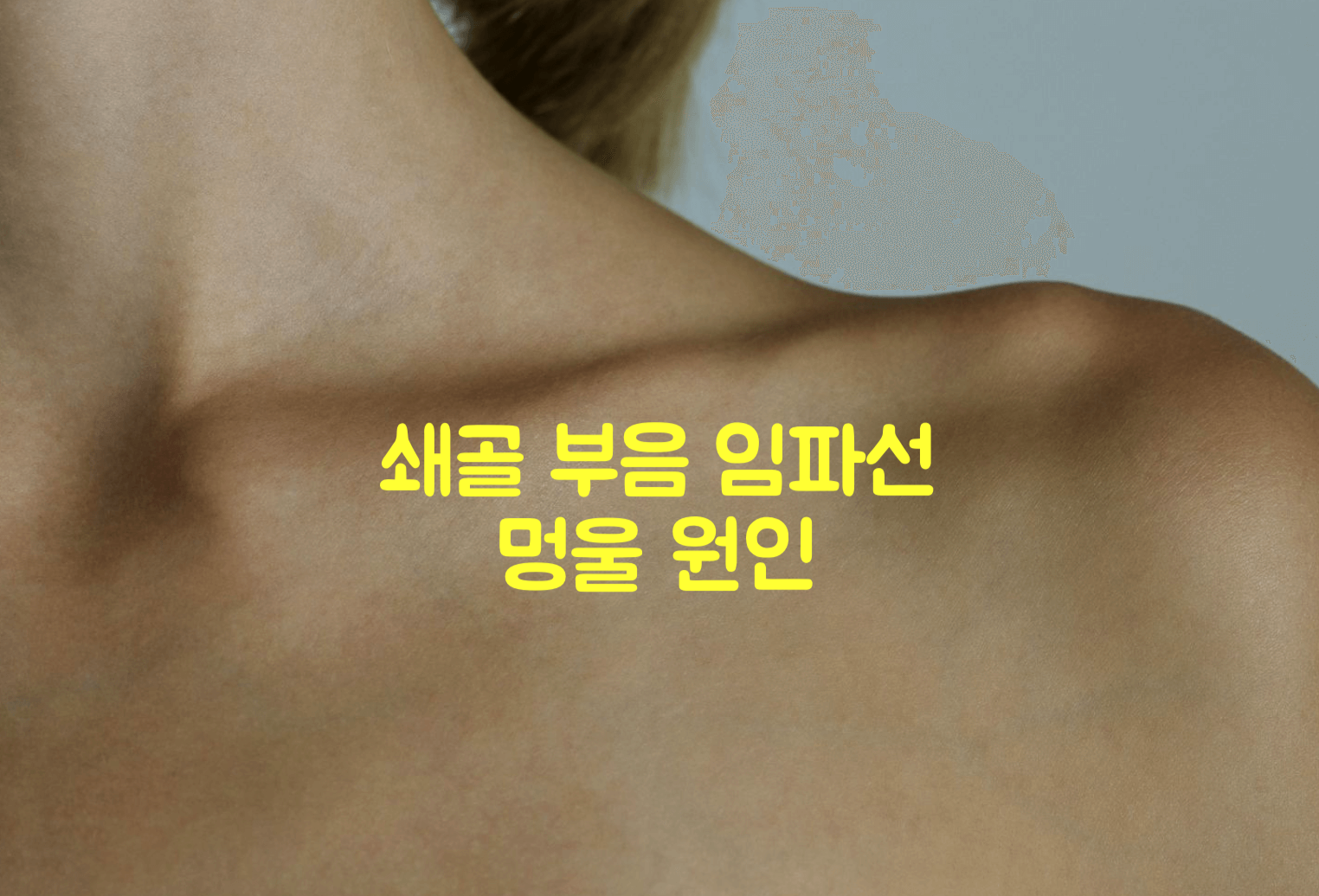 쇄골 부음