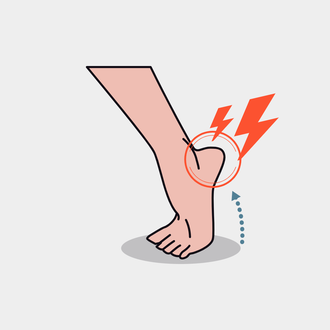 발뒤꿈치 통증 족저근막염 보조기 압통 운동방법