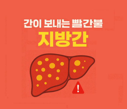 지방간 위험