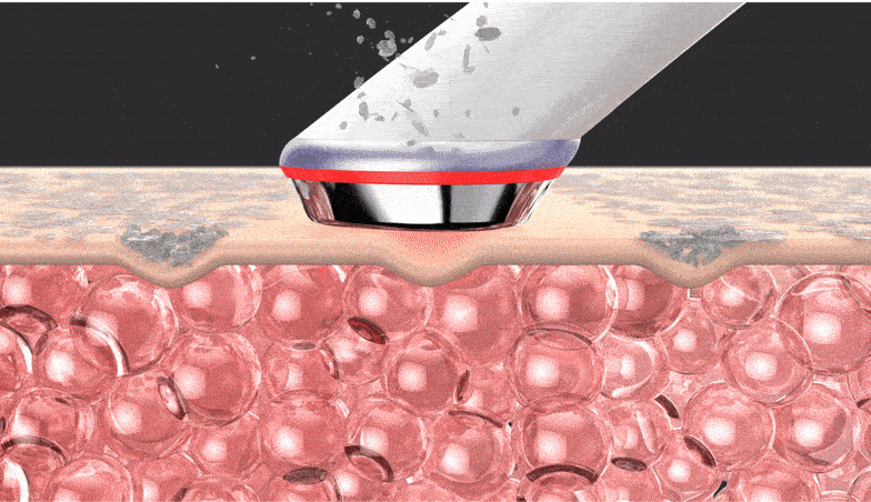 마데카프라임 원리