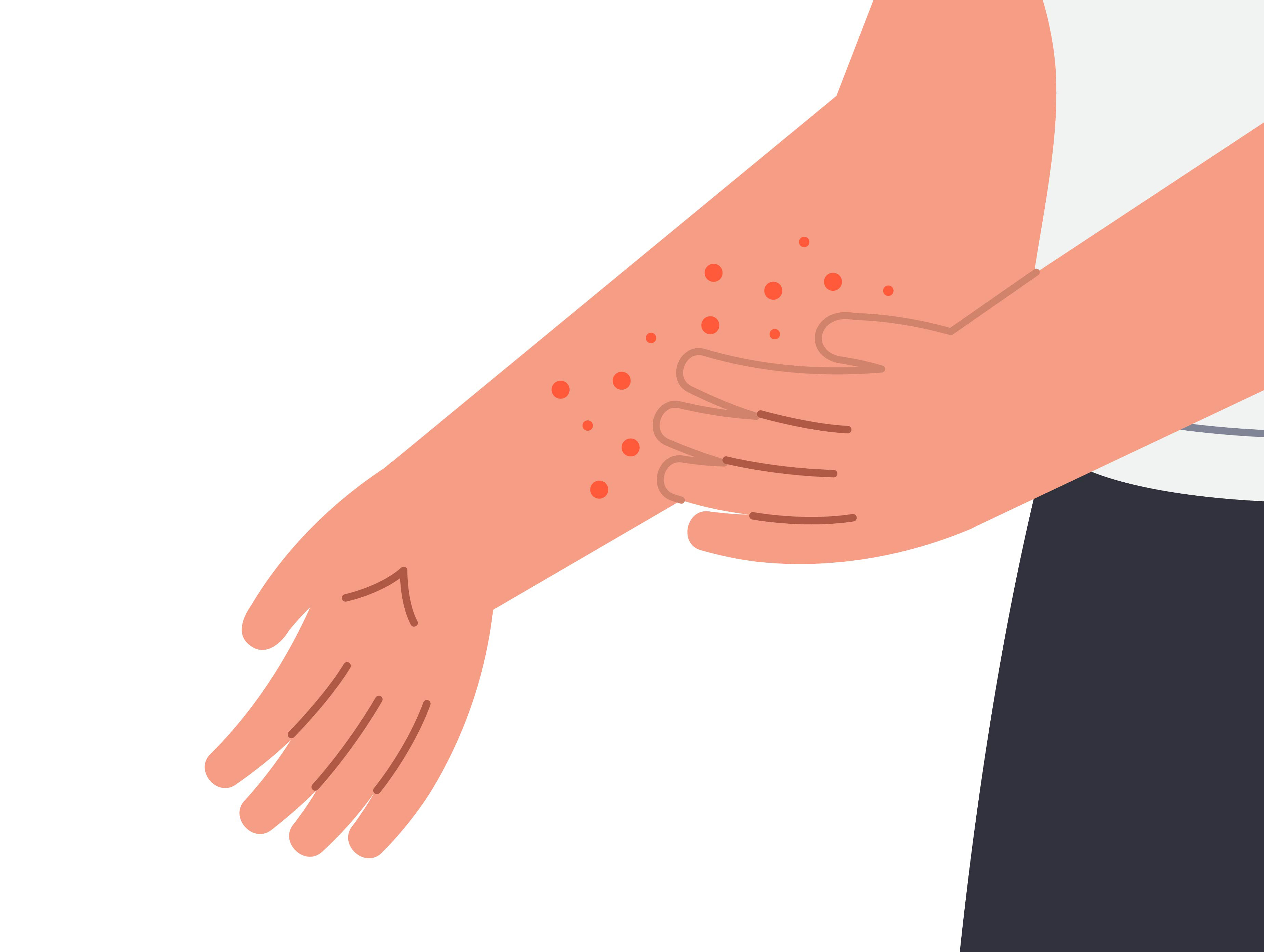 대상포진 예방접종