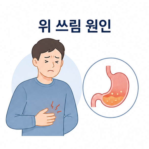 명치 부근이 쓰린 사람과 위장 그림으로 표현한 위 쓰림 원인 안내 이미지