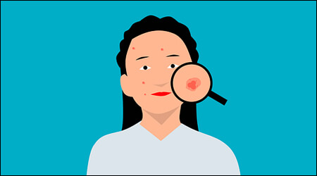 얼굴에 염증이 있는 여성