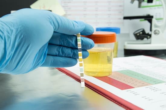 일반 건강 검진 소변 검사: 필수 정보와 자주 묻는 질문(FAQ)