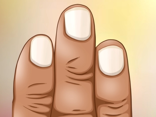 손톱에 세로줄이 생기는 이유