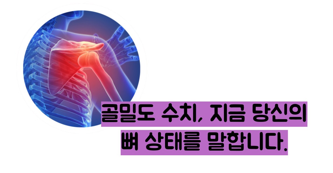 골다공증 수치