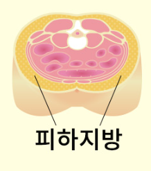 내장지방 빼는법