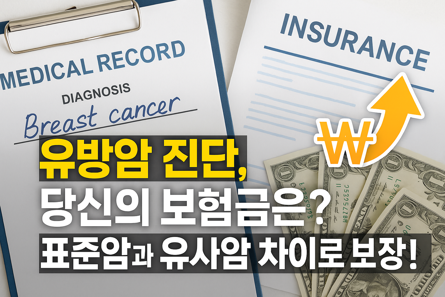 유방암 진단, 당신의 보험금은? 표준암과 유사암 차이로 보장 UP!