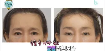 이마가 넓은 여자 관상 특징과 해석_12