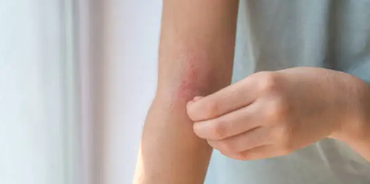 간단한 해충 관리: 여름철 모기와 파리를 막는 실용적인 방법