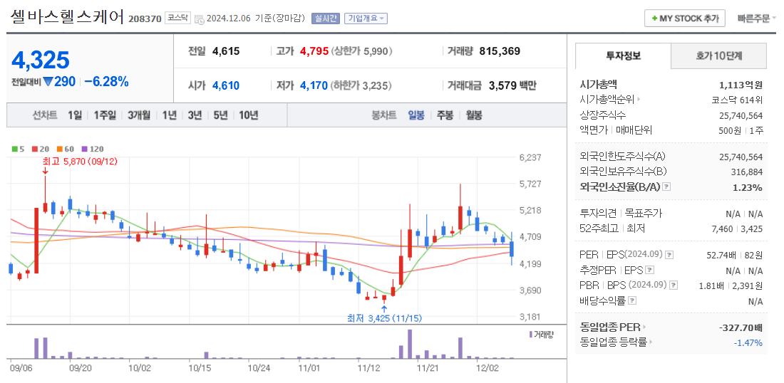 의료AI 관련주 셀바스헬스케어 주가 차트