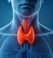 갑상선 기능 항진증
