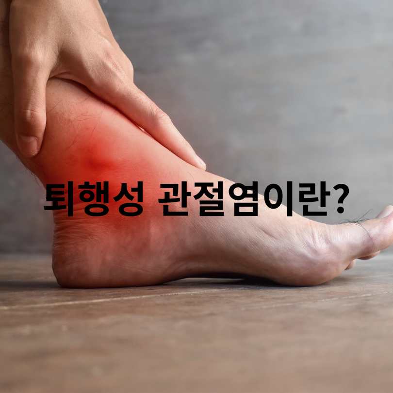 퇴행성 관절염과 류마티스 관절염의 차이점