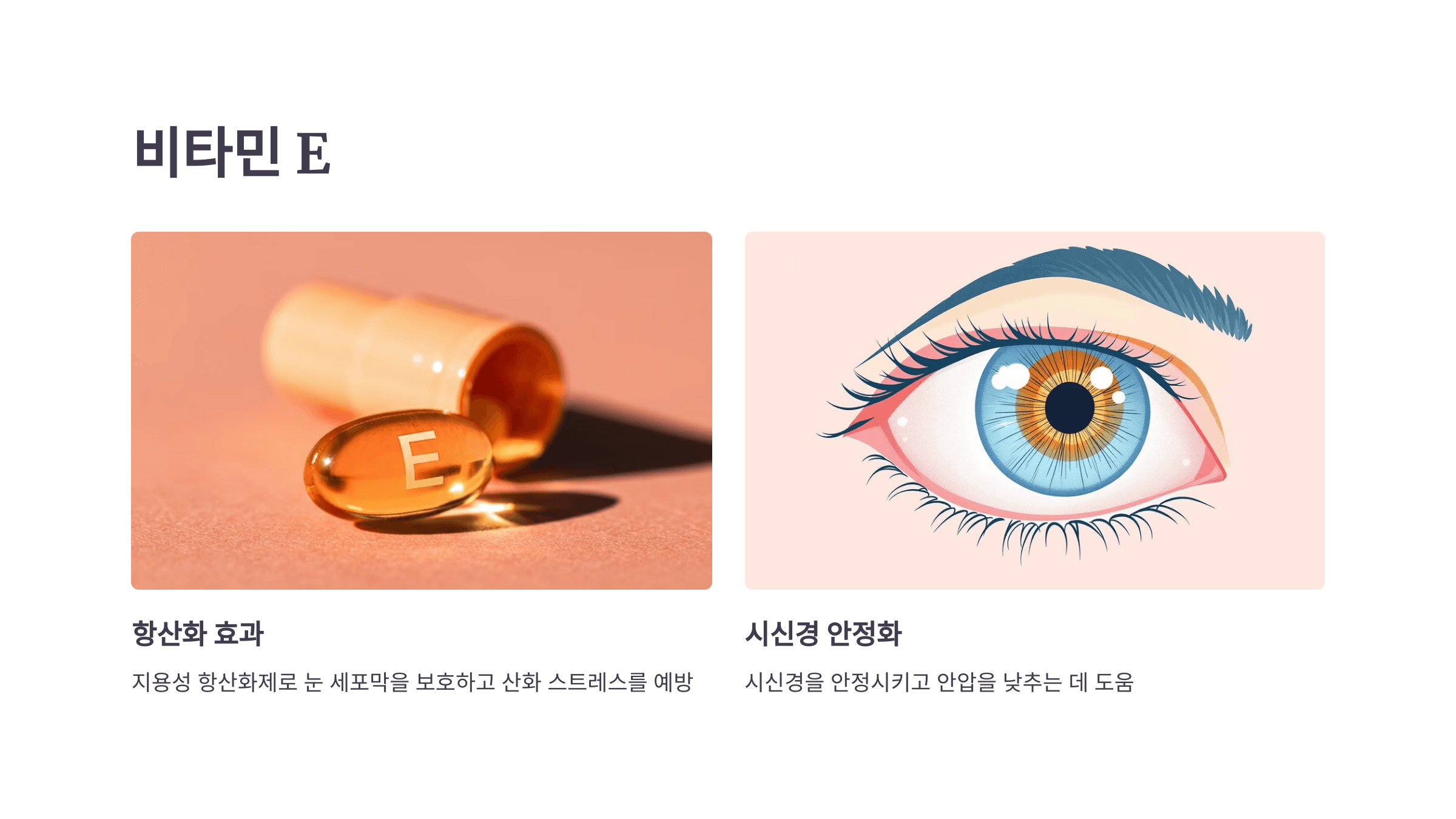 녹내장과 관련된 사진입니다.