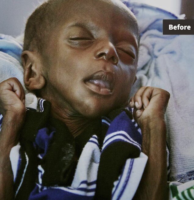 영양실조로 앙상한 레이몬드