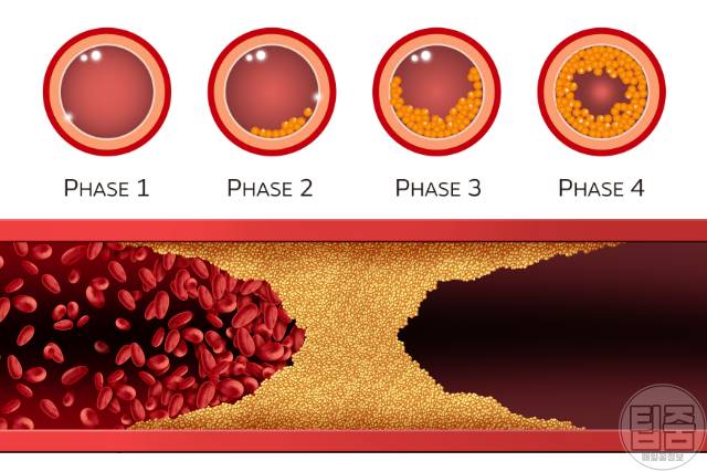 호두 효능 동맥경화,호두 하루 섭취량
