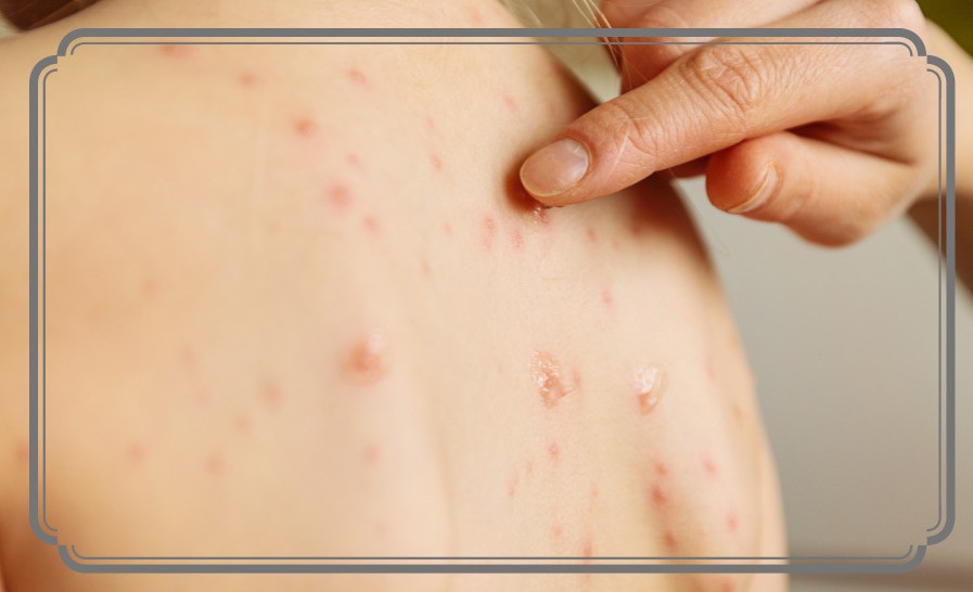 염증에 좋은 음식