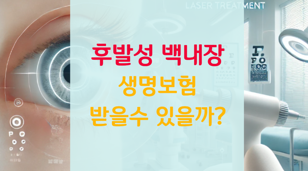 후발성 백내장 '생명보험 수술비' 받은 후기