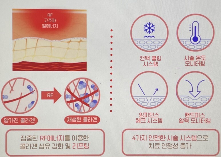 아이올리지오 후기