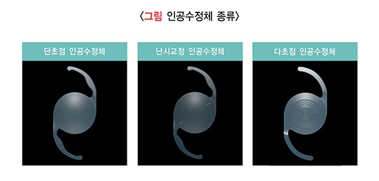 백내장