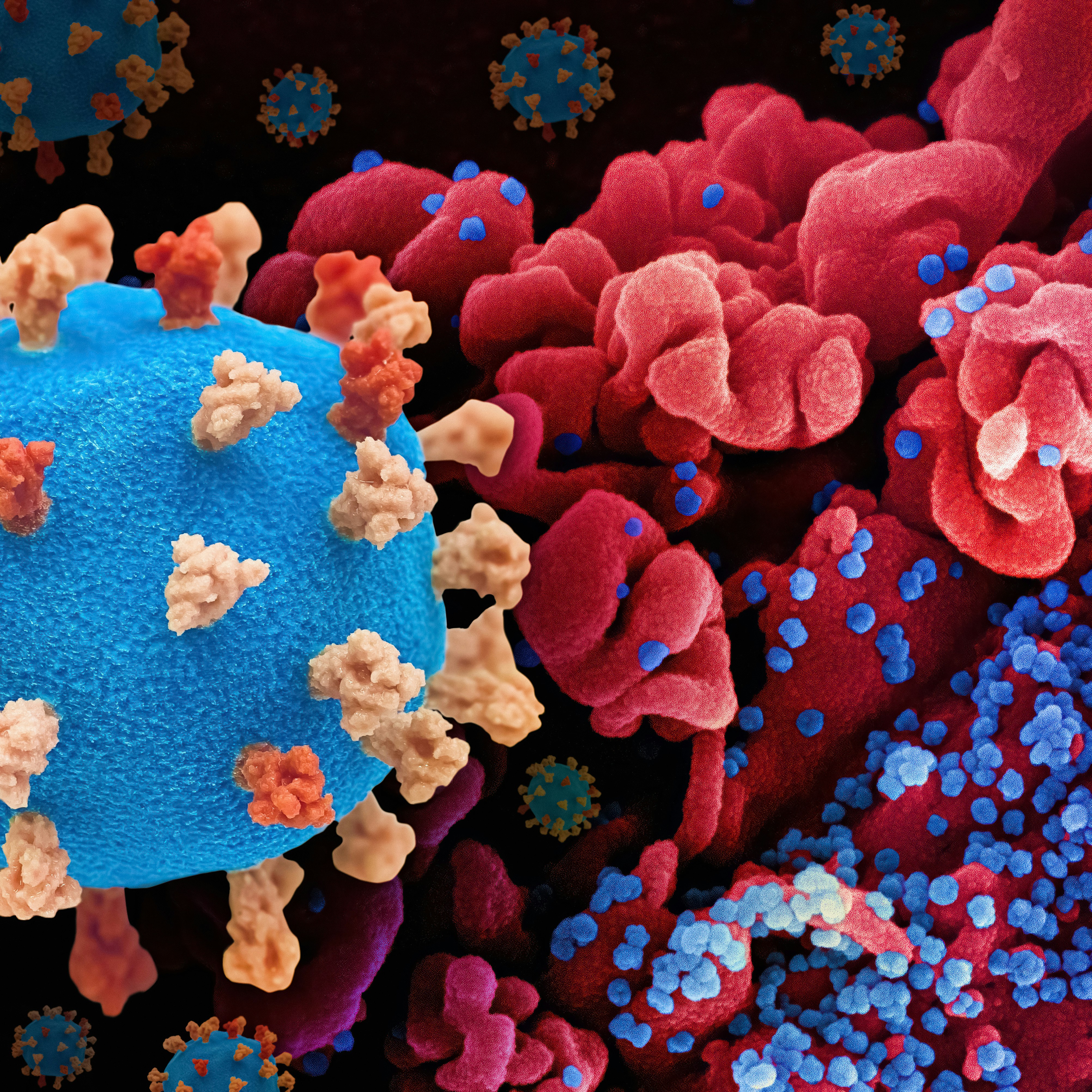 낙산균 6가지 효능 및 유산균과의 차이 (+ 부작용 제품 추천)