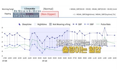 출렁이는혈압