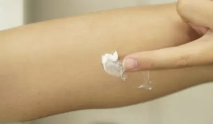 쥐젖 제거방법 17