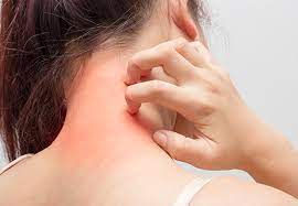 아마씨 효능 5가지와 부작용&amp;#44; 먹는법 아마씨유&amp;#44; 가루