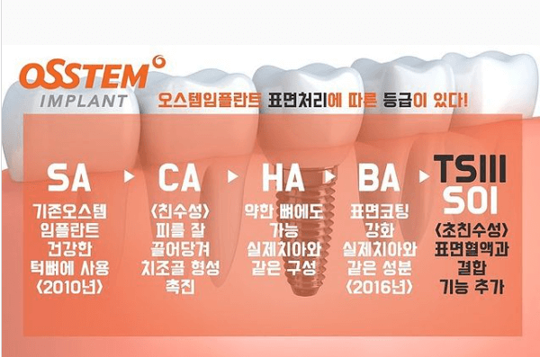 오스템임플란트가격-종류-추천이유