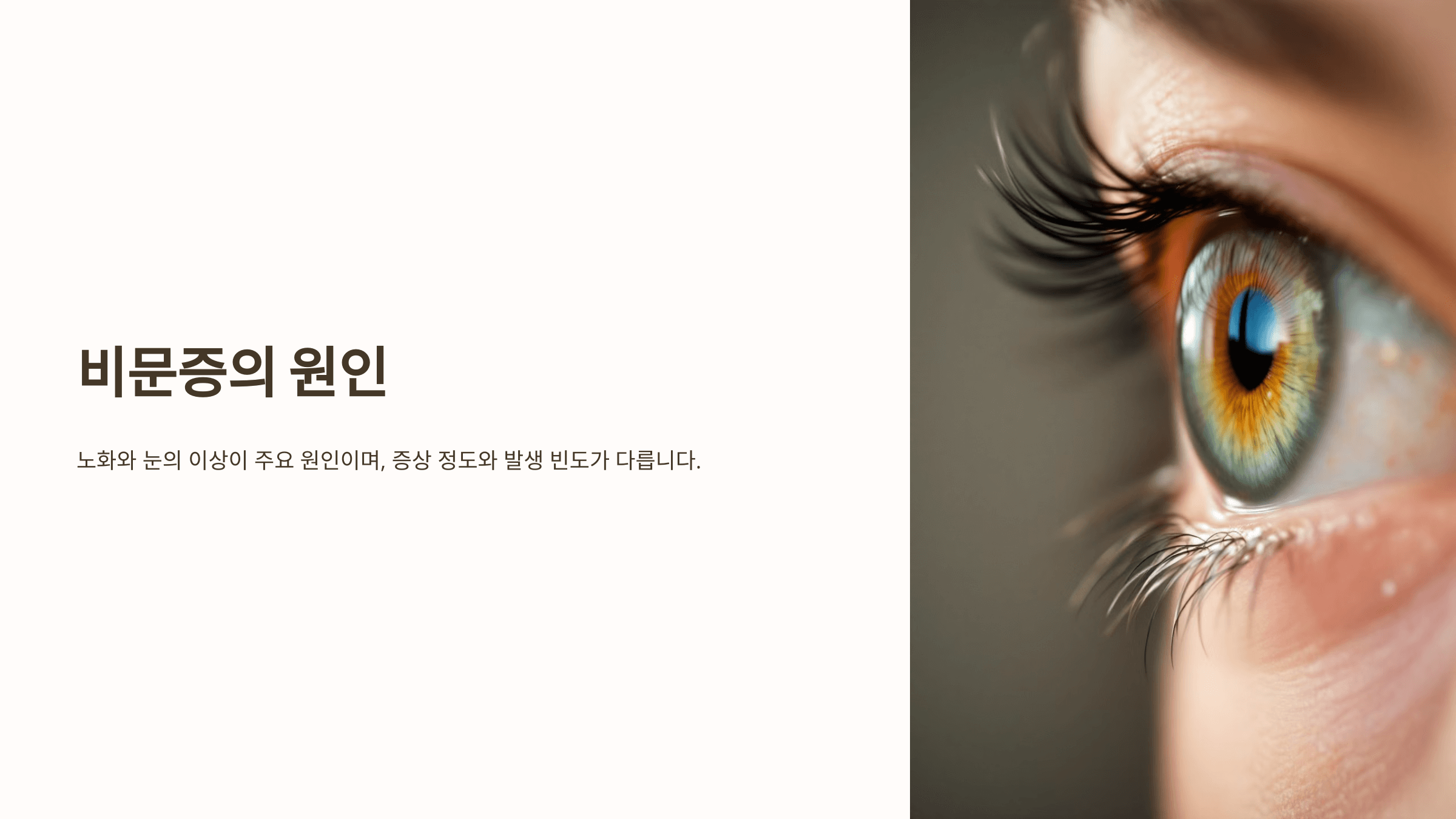 비문증과 관련된 사진입니다.