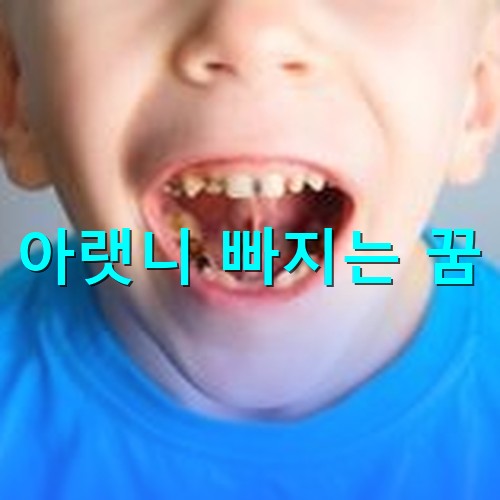 아랫니가-두개-연속으로-빠진-파란옷을-입은-아이가-입을-크게-벌리고-있는-모습