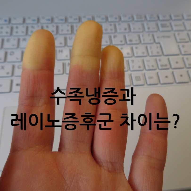 수족냉증과 레이노증후군 차이