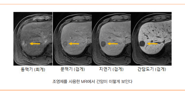 간암명의: 세브란스 김도영교수