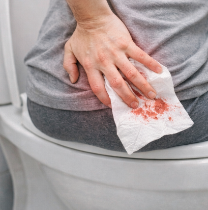 치질 증상 참으면 안 되는 이유 및 자가치료방법 알아보기