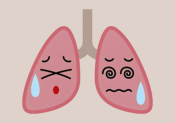 만성-질환에-기능이-저하된-폐