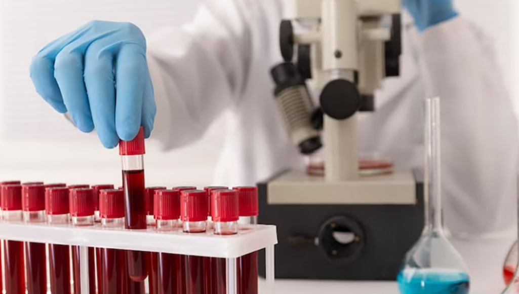 혈우병-증상과-치료